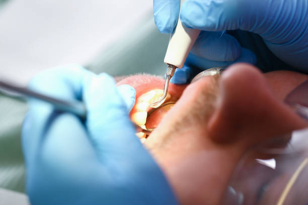 Best Emergency Treatment for Jaw Pain or Injury in Mount Ivy, NY